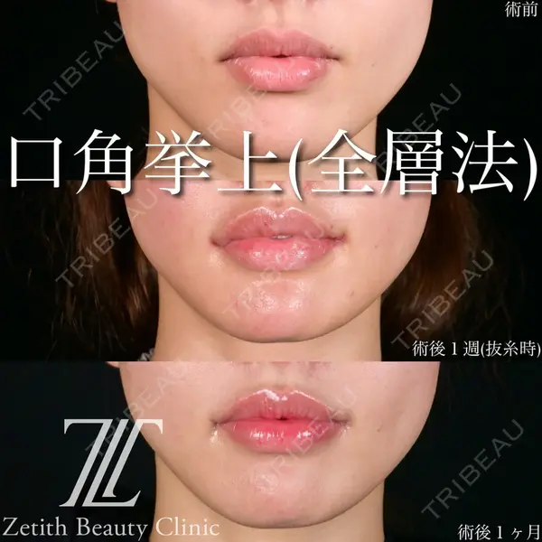 Zetith Beauty Clinic 池袋院 北村 翔医師の症例