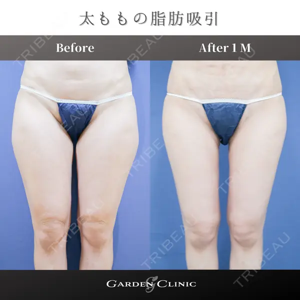 ガーデンクリニック 池袋院の症例