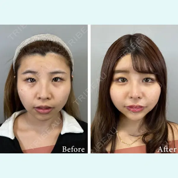 BELINDA CLINIC（ベリンダクリニック）新宿院の症例