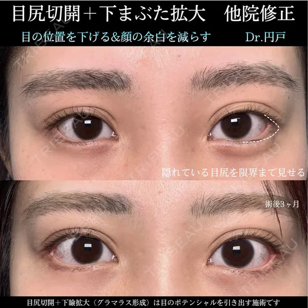 eクリニック 那覇院の症例