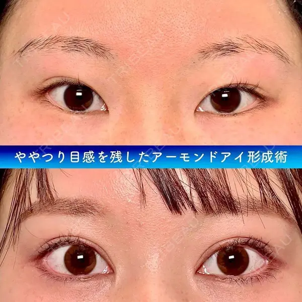 eクリニック 金沢本院の症例