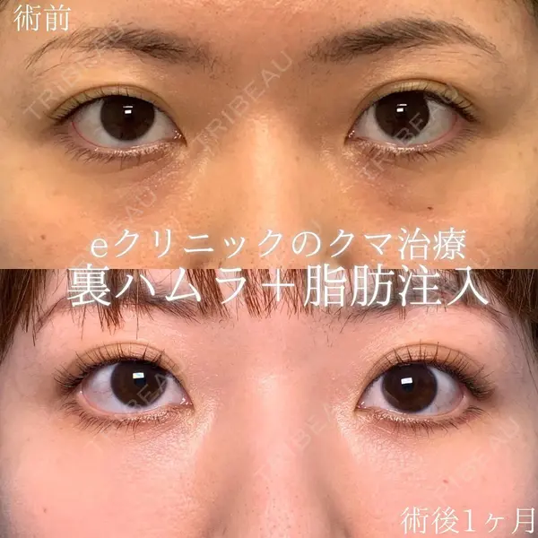 eクリニック 札幌院 岩井 勝矢医師の症例