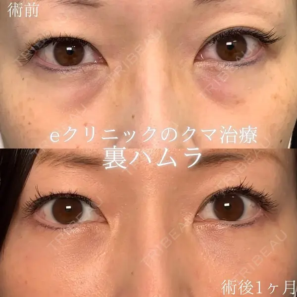 eクリニック 新宿院 劉 奕阳医師の症例