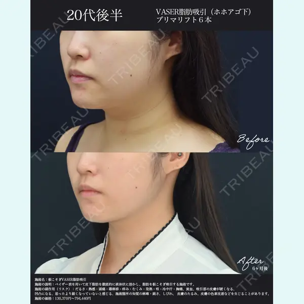 湘南美容クリニック 名古屋院 山本 高士医師の症例