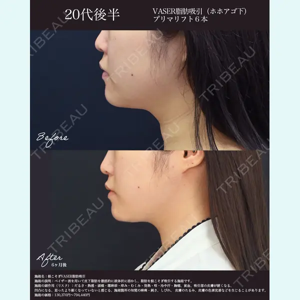 湘南美容クリニック 名古屋院 山本 高士医師の症例