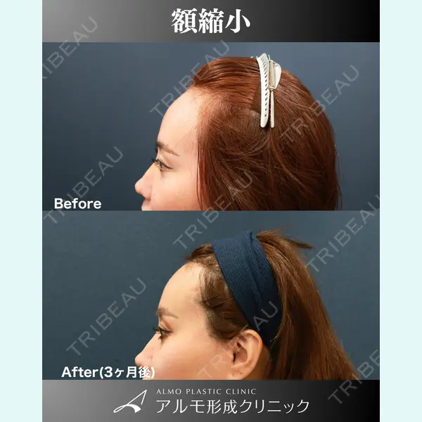 アルモ形成クリニック 内田 直宏医師の症例