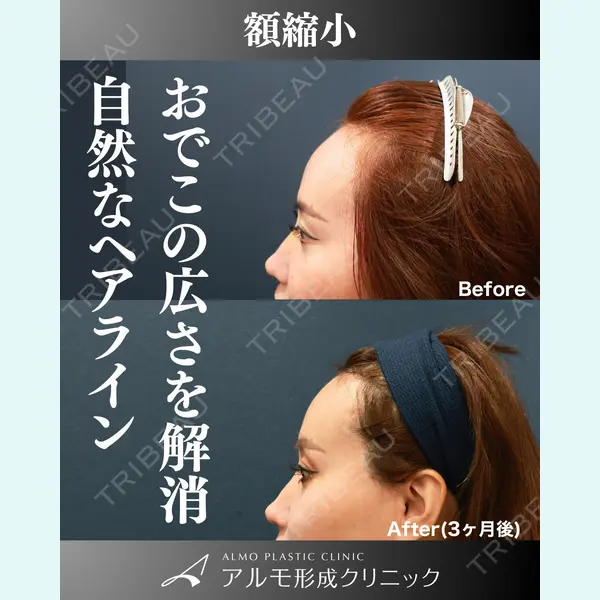 アルモ形成クリニック 内田 直宏医師の症例