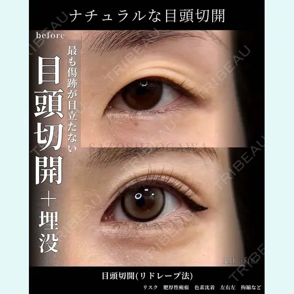 グローバルビューティークリニック 大阪院の症例