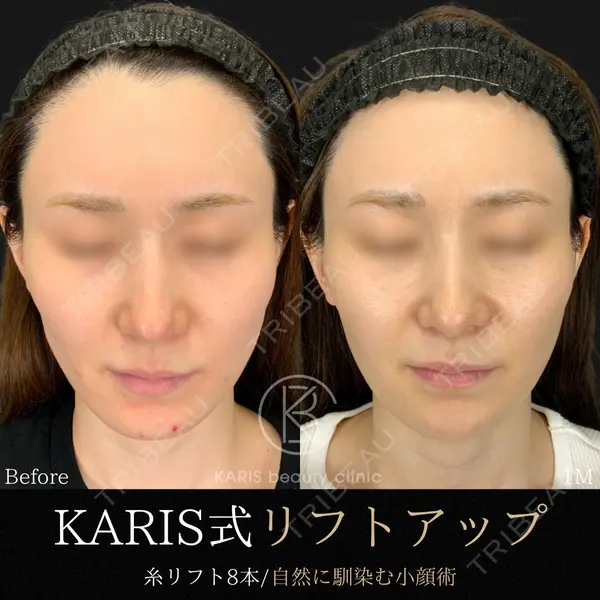 KARIS beauty clinic 滝内 ヒロフミ医師の症例