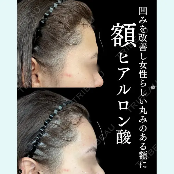 ルラ美容クリニック 上野院の症例