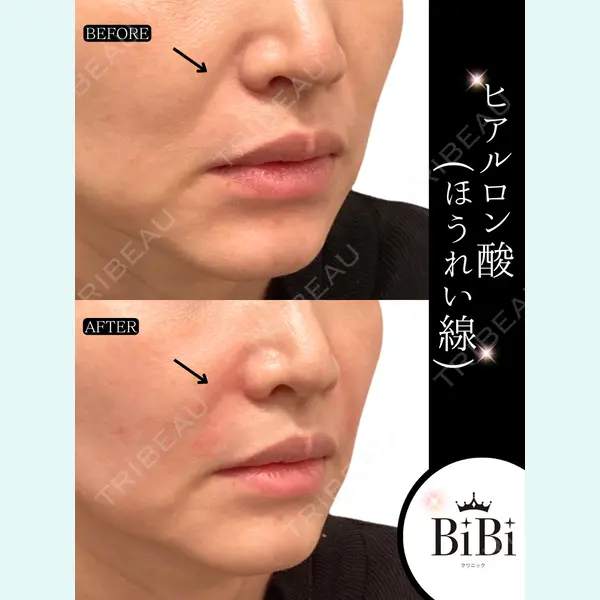 BiBiクリニック 山本 幸一郎医師の症例
