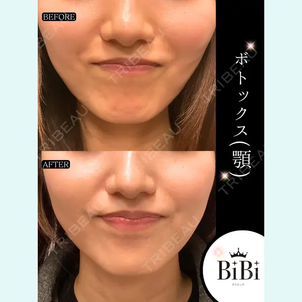 BiBiクリニック 山本 幸一郎医師の症例