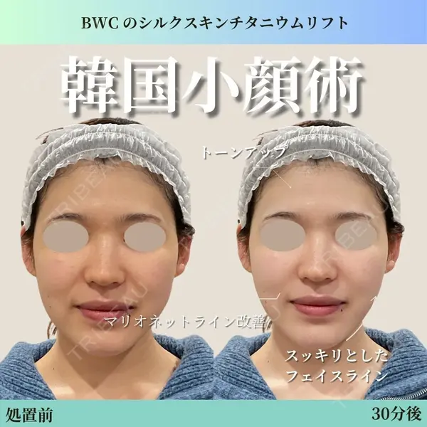 ビューティー和心クリニック 浅草院の症例