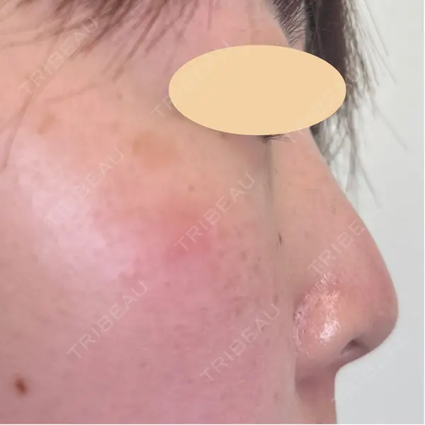 lime clinic （杏クリニック）の症例