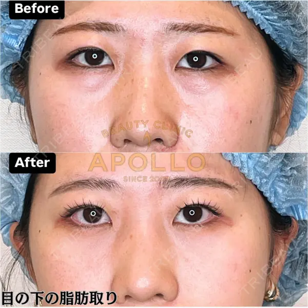 APOLLO BEAUTY CLINICの症例