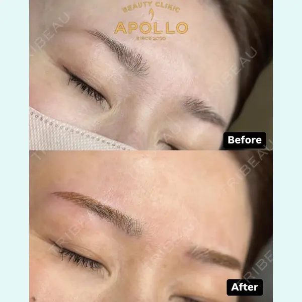 APOLLO BEAUTY CLINIC 鬼沢 正道医師の症例