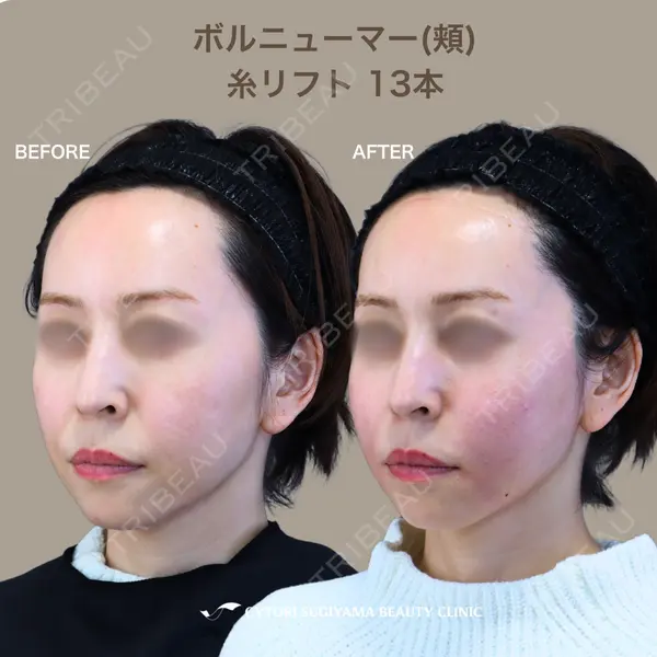 サイトリ杉山美容クリニックの症例