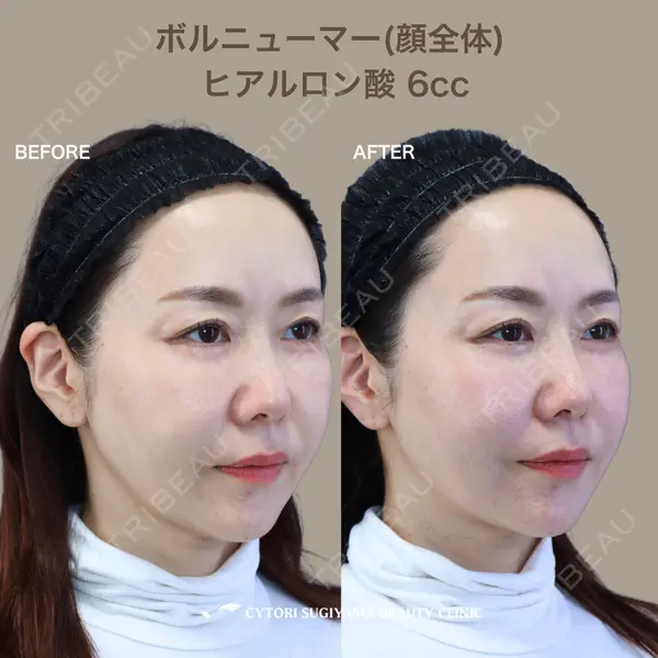 サイトリ杉山美容クリニックの症例