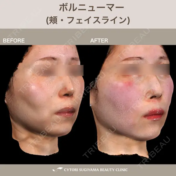 サイトリ杉山美容クリニックの症例