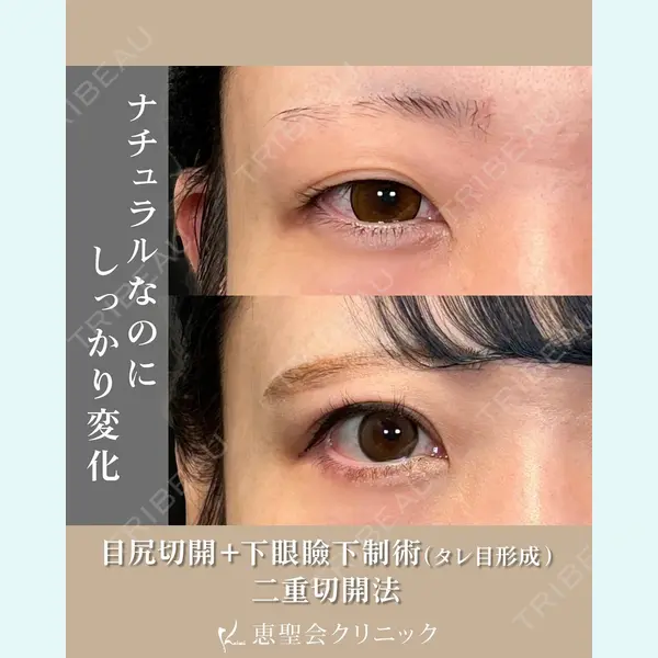 恵聖会クリニック 京橋院 田川 大地医師の症例