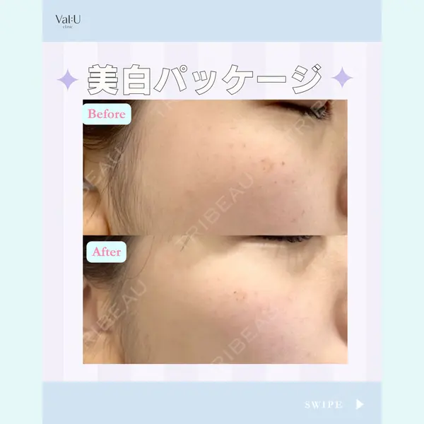 Valu （バリュー） クリニック イ・スンヒョン医師の症例
