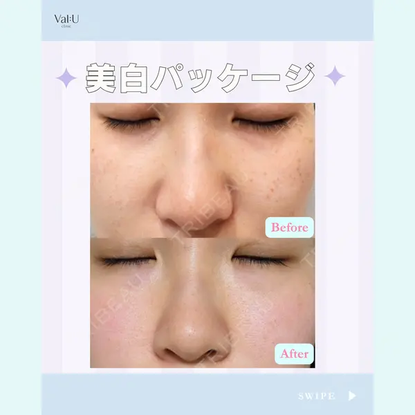 Valu （バリュー） クリニック イ・スンヒョン医師の症例