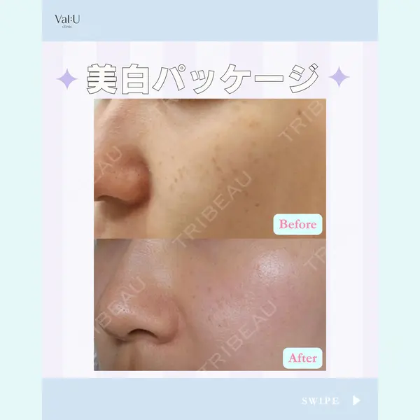 Valu （バリュー） クリニック イ・スンヒョン医師の症例