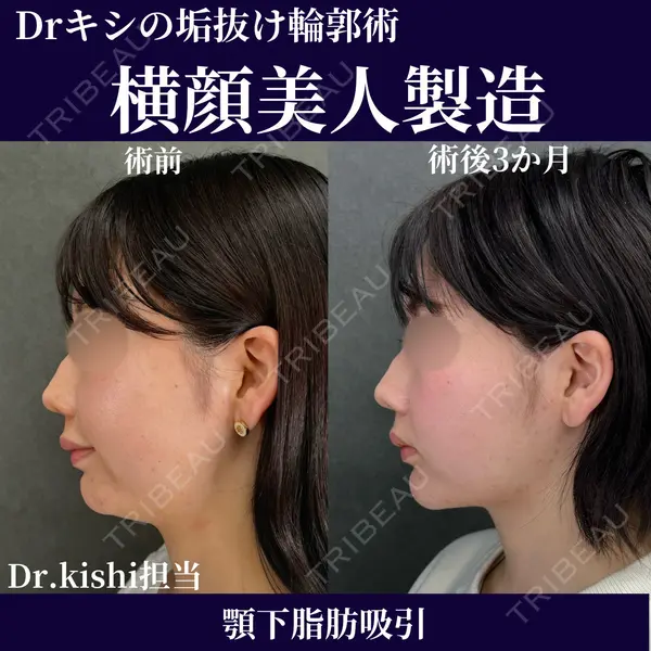 ネビュラクリニック 京都院 岸 大輔医師の症例