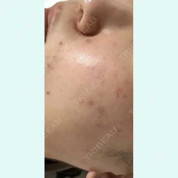 しんゆり美容健康クリニックの症例