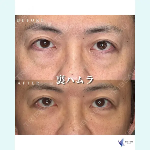 BIOTOPE CLINIC 【ビオトープクリニック】 苅部 淳医師の症例