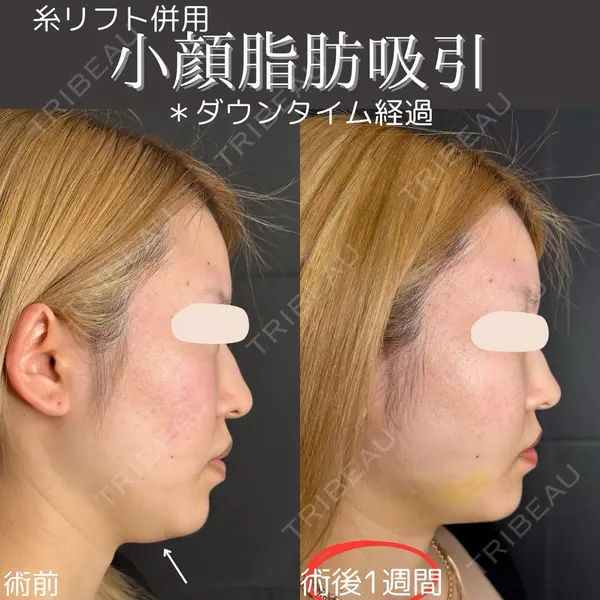 ルラ美容クリニック 仙台院 橋本 英樹医師の症例