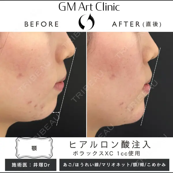 G MEDICAL ART クリニック 新宿院の症例
