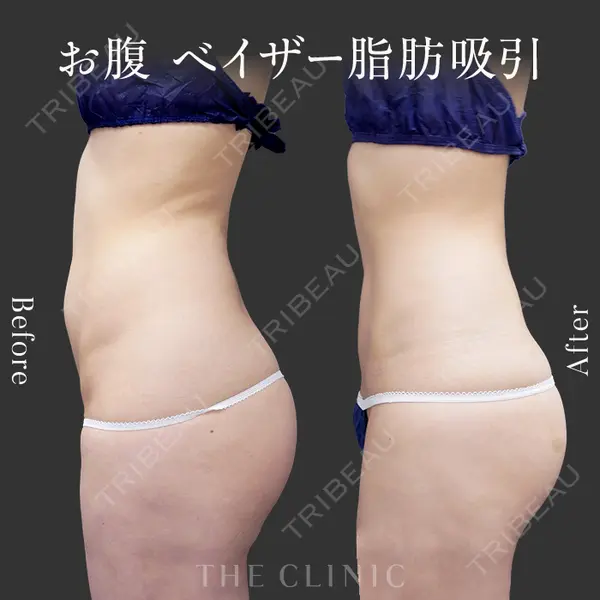 THE CLINIC（ザ・クリニック） 広島院 木村 圭吾医師の症例