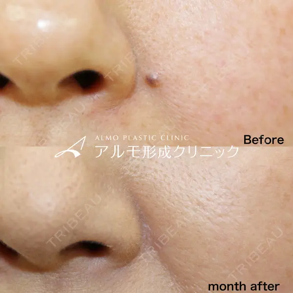 アルモ形成クリニック 内田 直宏医師の症例