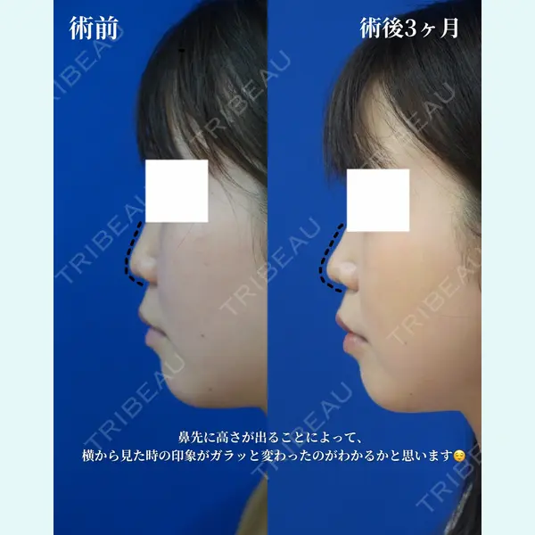 リッツ美容外科 大阪院の症例