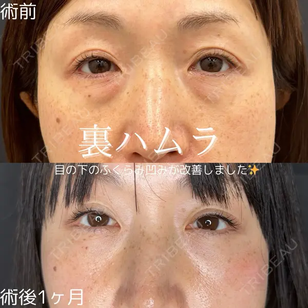 ルラ美容クリニック 仙台院 橋本 英樹医師の症例