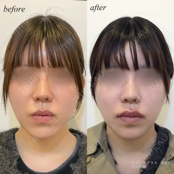 DMTC美容皮膚科 日本橋院 山中大介医師の症例