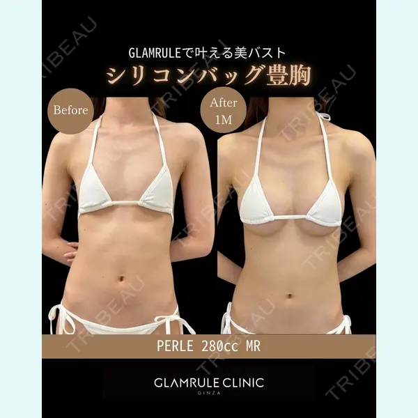 GLAMRULE CLINIC (グラムルール クリニック) 銀座院 藤林 万里子医師の症例