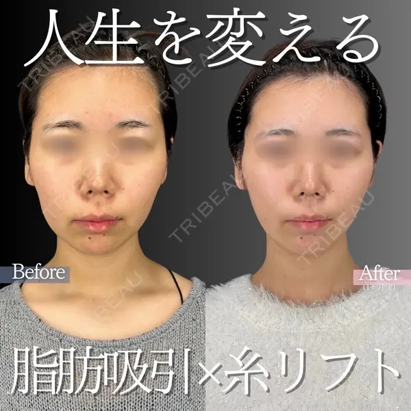 白金ビークリニック 本院の症例