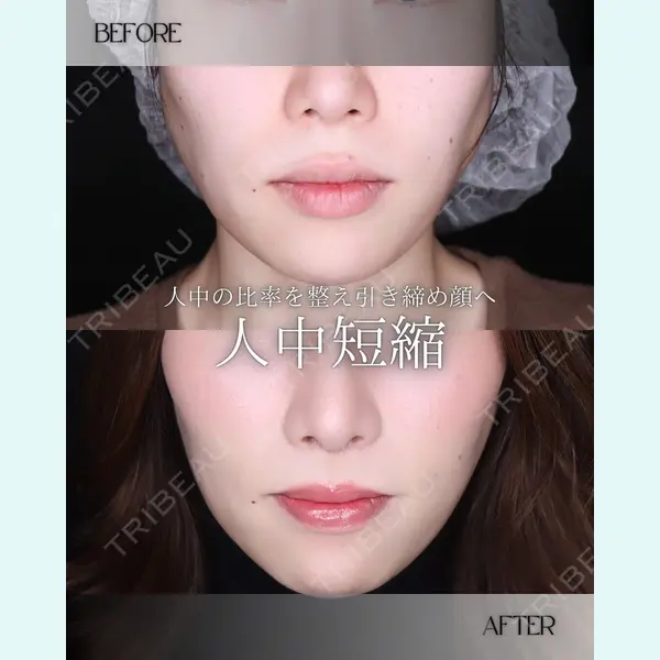 小倉美容外科/美容皮膚科 ビラビューティークリニック 大村 亞蘭医師の症例