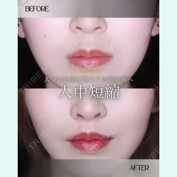 小倉美容外科/美容皮膚科 ビラビューティークリニック 大村 亞蘭医師の症例