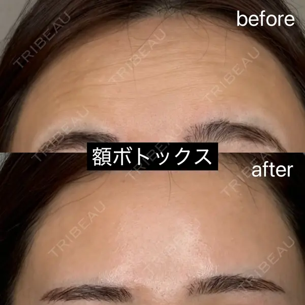 Belle Via Clinicの症例