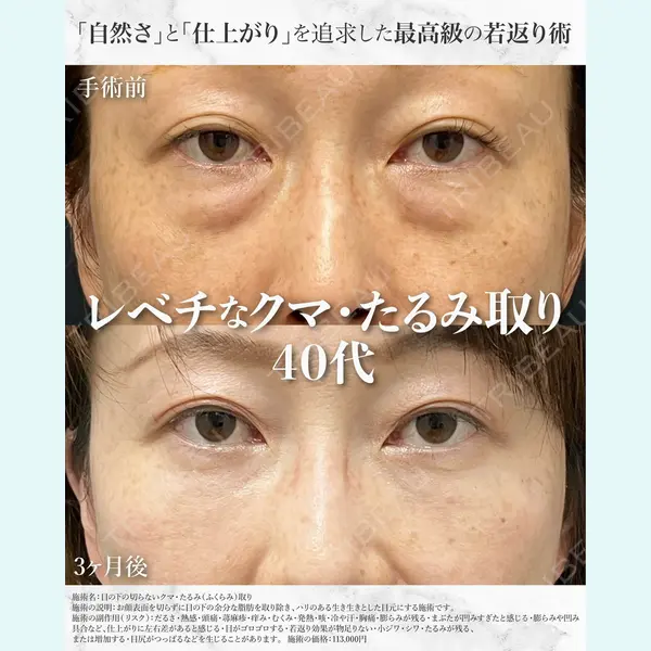 湘南美容クリニック 浜松院 小泉 佑太医師の症例