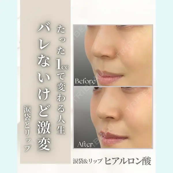 APスキンクリニック銀座 高麗 惠理医師の症例