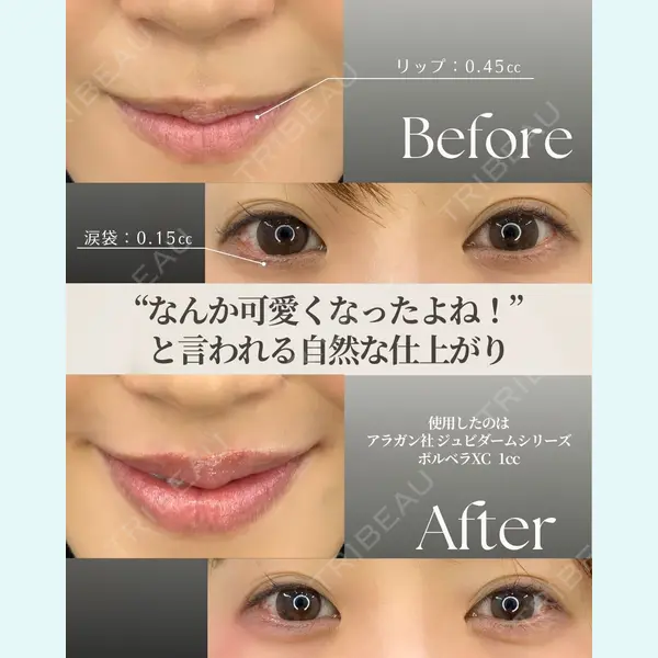APスキンクリニック銀座 高麗 惠理医師の症例