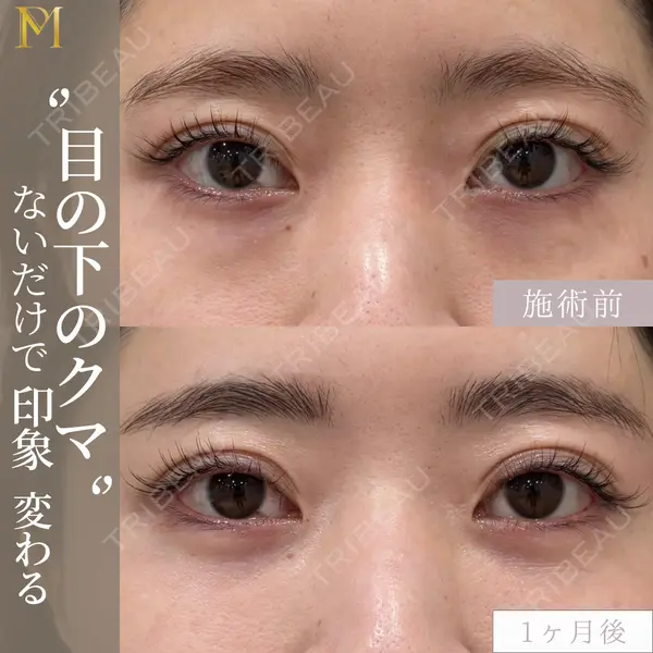 PureMe Skin Clinic（ピュアミースキンクリニック麻布） 福田 麻衣医師の症例