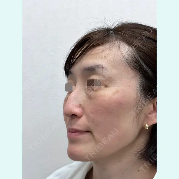 GRACY TOKYO CLINIC【グレイシートウキョウクリニック】 大西 真代医師の症例