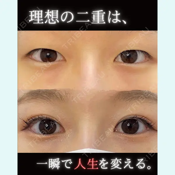 ルラ美容クリニック 池袋院 日名地 あゆみ医師の症例