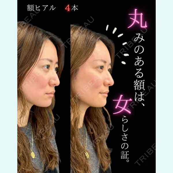 ルラ美容クリニック 池袋院 日名地 あゆみ医師の症例