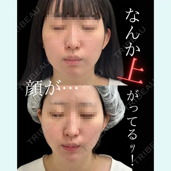 ルラ美容クリニック 池袋院 日名地 あゆみ医師の症例